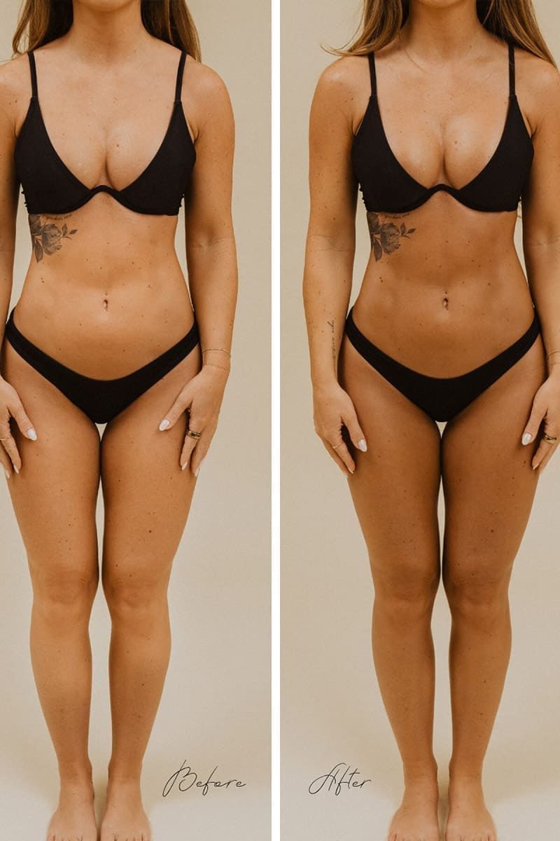 Before and after SJOLIE Original N°12 Dark spray tan on a woman in a black bikini