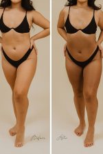 Before and after photos of a model tanned with SJOLIE Luxe N°9 Medium