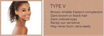 Type V